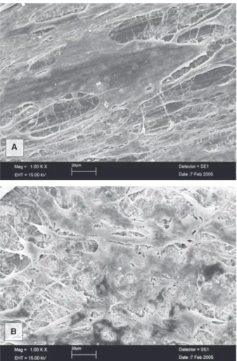 Fig. 4. Scanning electron microscopy images of primary human osteoblasts cocultured with zirconia; (A) machined substrate surface, (B) rough, air-borne particle abraded substrate surface.
