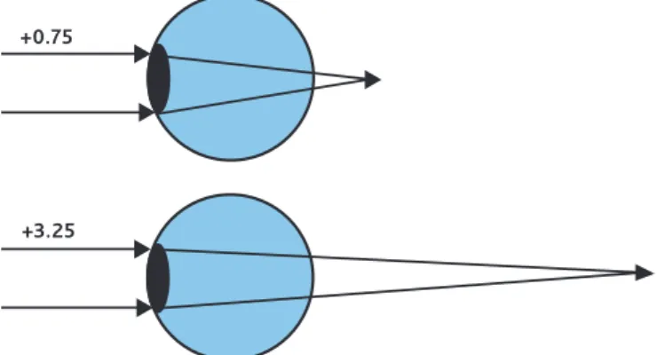 Figure 2a. Uncorrected, with no accommodation. 