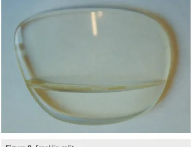Figure 8. Franklin split.