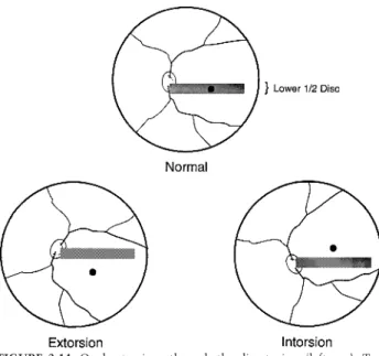 FIGURE 3-14. Ocular torsions through the direct view (left eye). Top: