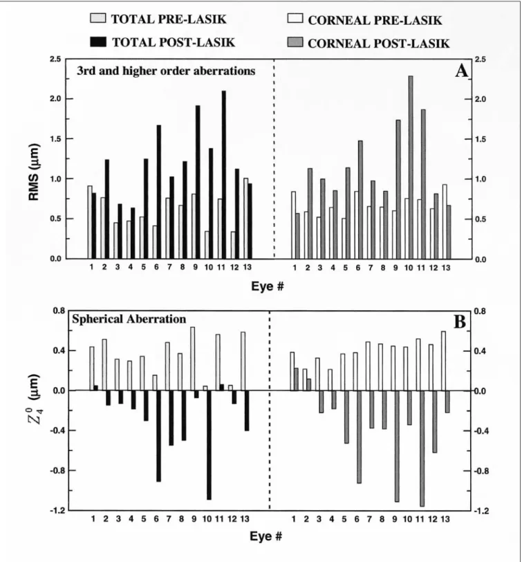 Figure 2. Total (left) and corneal (right) third and higher order: A) RMS wavefront error, and B) spherical aberration, before (light bars) and after (dark bars) hyperopic LASIK for the 13 eyes in the study