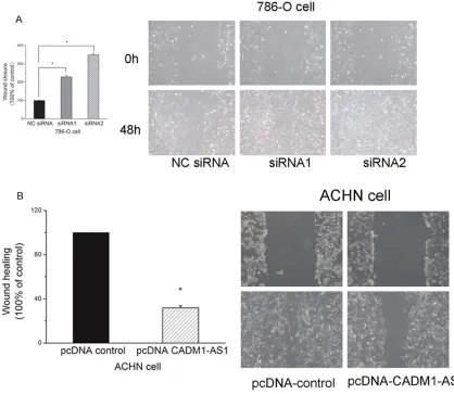 Figure 6. Cell growth cure of 786-O cells and ACHN cells. A. Cell growth cure of 786-O cells after knockdown CADM1-AS1 by siRNA