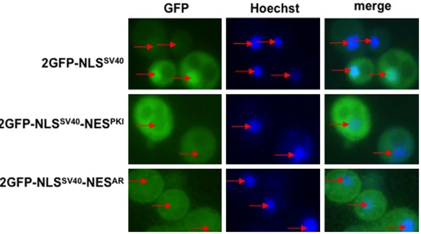Figure 3. Sxm1 is required for ligand dependent nuclear localization of AR. sxm1Δ yeast strain was transformed with GFP-AR alone or GFP-AR and a WT copy of Sxm1 (+Sxm1) and grown in the presence ligand (+DHT)
