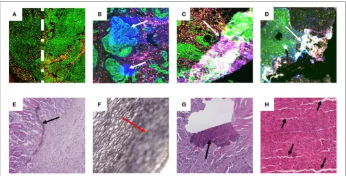 FIGURE 1 | Examples of artifact in both ﬂuorescence and brightﬁeld captured images. Images (A–D) are examples of multiplex IF images containing different types ofartifacts