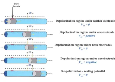 Figure 4. A potential difference is produced across the two electrodes as the depolarisation region generated by the action potential passes beneath them