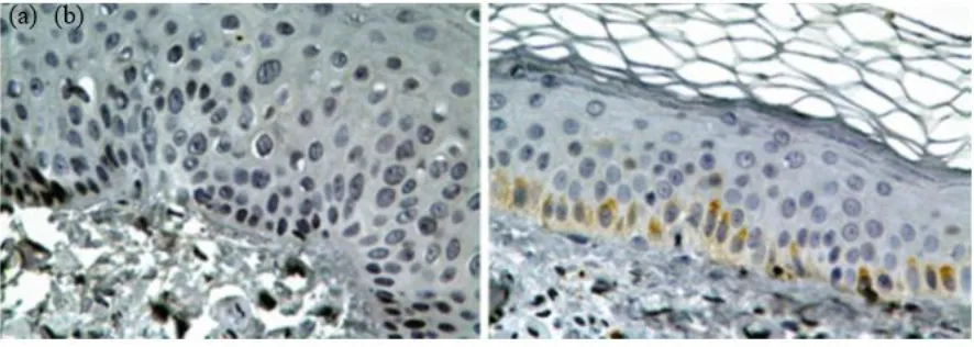 Fig. 7: skin bopsy. Epidermal cells (a) before and (b) after transplantation (Source: Reference 56) 