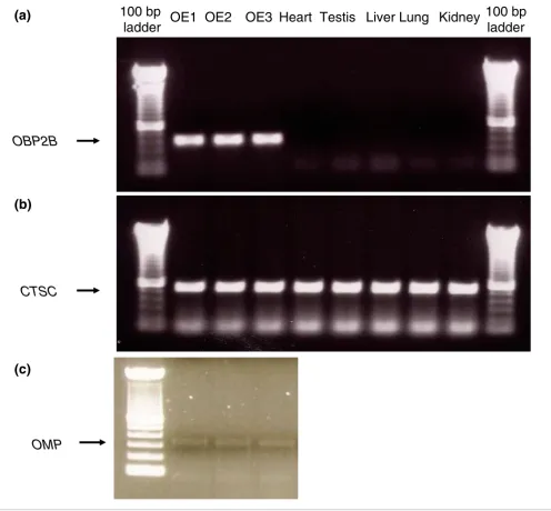 Figure 1Gel electrophoresis of PCR amplification results using cDNA from three olfactory epithelium tissues, heart, testis, liver, lung, and kidney as template