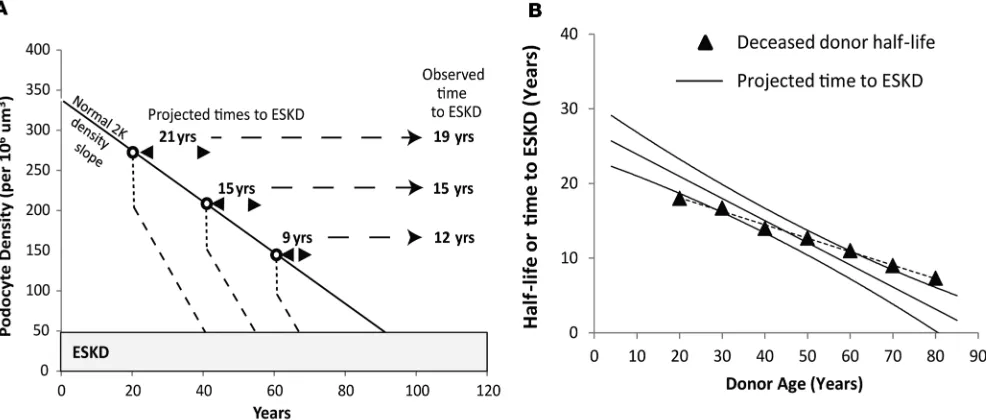 Figure 5. Simulation of allograft time to ESKD versus donor age derived from podometric data and comparison to observed transplant outcomes data versus age