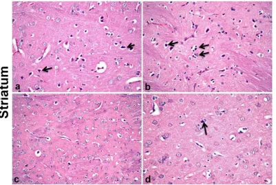 Fig. (5): Histological section of striatum of KCr-treated rat (a-b) and KCr+ZME - treated rat (c-d): a) Striatum showing necrosis of neurons (arrow) (H&E,X400)