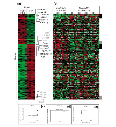 Figure 5Mouse prostate strain-associated gene expression and analysis in human prostate tissues: FVB/N and C57BL/6