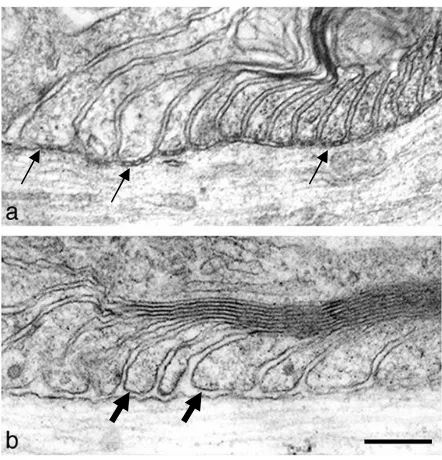 Figure 1.9. Electron micrographs of paranodes in wild type and neurofascin-nullmice. In wild-type mice, paranodal loops connect to the axons with septate-likejunctions as indicated by arrows (a), but these connections are disrupted and the gapsbetween loops and the axon (block arrows) are greater in neurofascin-null mice (b).Taken from Sherman et al., 2005.