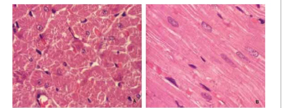 Figure . (A and B) presents normal myocardial tissue 