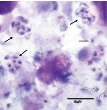 FIG. 2. Pneumocystis carinii trophic and cyst forms. Touch preparation of an infected rat lung stained with a rapid variant of the Wright-Giemsastain