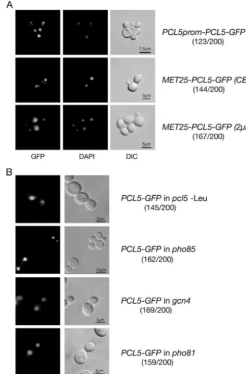 FIG. 1. Pcl5-GFP is transported into the S. cerevisiae nucleus.(A) Nuclear localization of high and low amounts of the functional