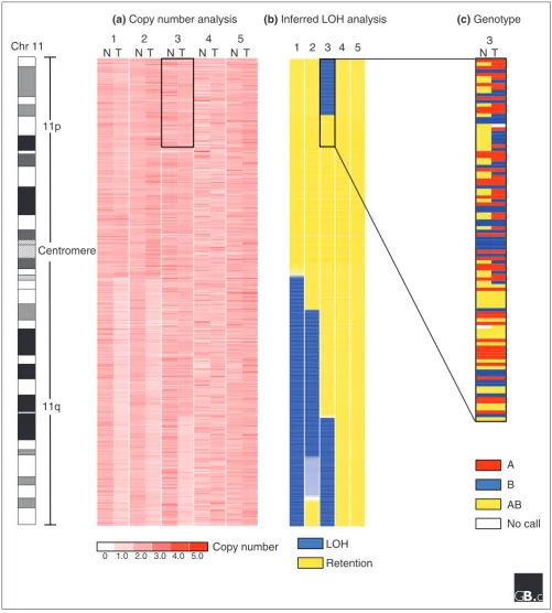 Figure 1Illustration of SNP array analysis by example of matched neuroblastoma samples using the dChip software [25,26]