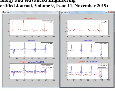 Fig. 5: Enhanced ECG of 100.dat 