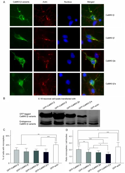 Figure 2. Colocalization of CaMKIIβ variants with F-actin in microspikes. A. CaMKIIβ variants preferentially localized to F-actin-rich structures: Confocal images of E-18 cortical neurons at 4 DIV with mGFP tagged CaMKIIβ variants (green) and F-actin label