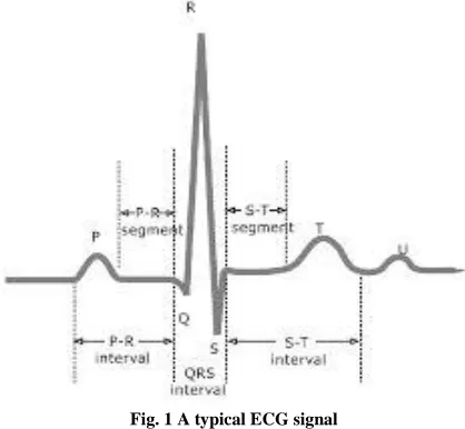Fig. 1 A typical ECG signal 