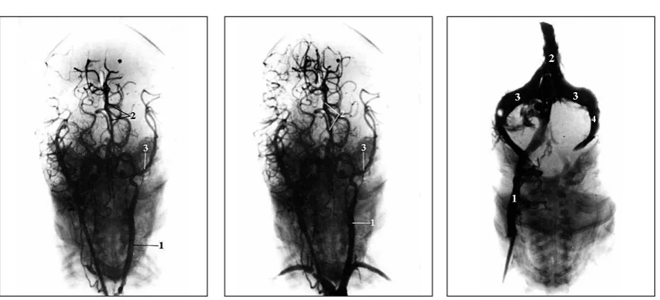 Fig. 7.  Dural sinuses AP projection.