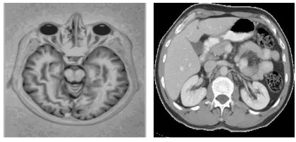 Figure 1: MRI image of brain and CT image of abdomen