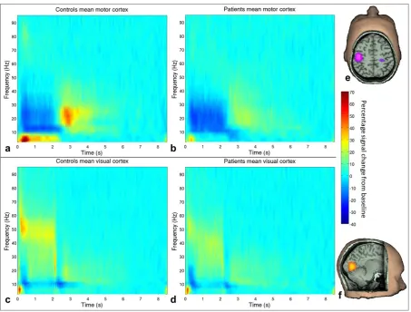Figure 1: Time frequency spectrograms.  Percentage change from baseline in the trial-