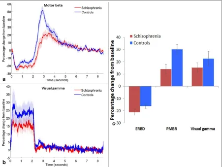 Figure 2: Beta and gamma band responses.  Mean timecourse of beta band amplitude in 