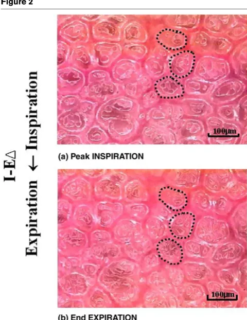 Figure 1Figure 2