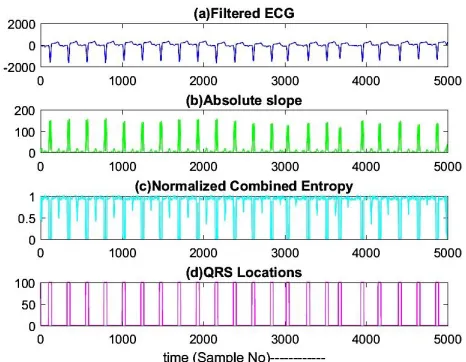 FIG(. 2- RESULTS OBTAINED AT VARIOUS STEPS OF THE ALGORITHM - A) FILTERED ECG, (B) ABSOLUTE SLOPE OF ECG, (C) NORMALIZED COMBINED ENTROPY, (D) QRS-COMPLEXES IDENTIFIED BY THE ALGORITHM  