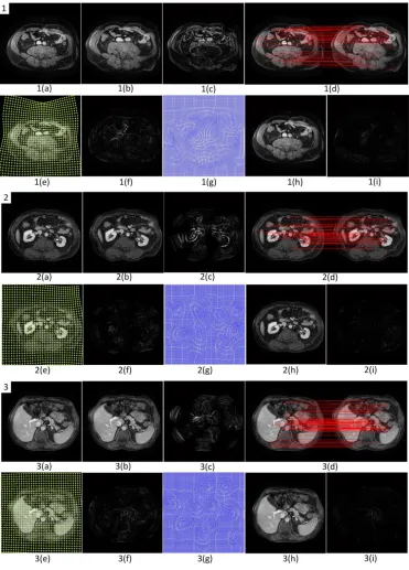 Fig. 4:   Three sets of experimental results produced by our coarse-to-fine registration algorithm 