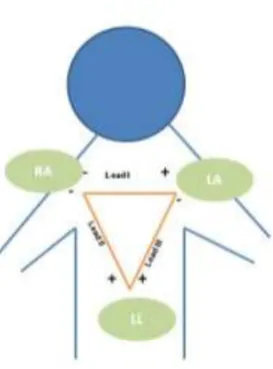 Figure 1: ECG Signal [6] 
