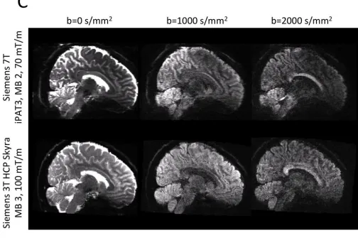 Figure 1. Representative examples of dMRI from Siemens 7 T and 3 T HCP systems. The resolution 