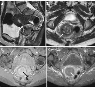 Fig. 8 Pelvic inflammatory disease with pyosalpinx on ultrasound. Thispatient presented to the emergency department with lower abdominalpain, pyrexia and vomiting