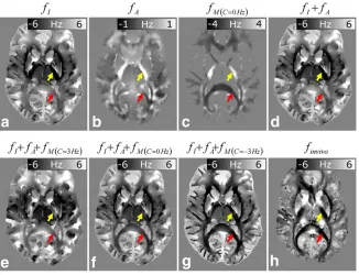 FIG. 4. Representative axial slices at the level of the optic radiations of the data sets used to carry out whole brain frequency simula-tions.rior–posterior, blue (a) Isotropic susceptibility map, xI, based on a segmented white matter image from a T1-weig