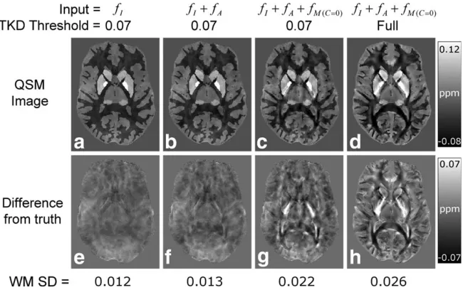 FIG. 6. Representative slices showing the results of the QSM calculations. The figure shows susceptibility maps produced by applyingTKD-based QSM with a truncation threshold of 0.07 to fI (A), fI þ fA (B), and fI þ fA þ fMðC¼0Þ (C) data