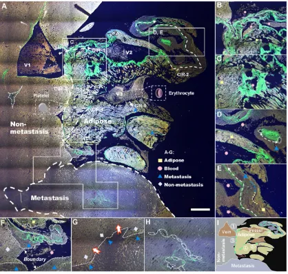 Figure 3. Label-free whole-colony imaging of liver section of metastatic cancer by SLAM