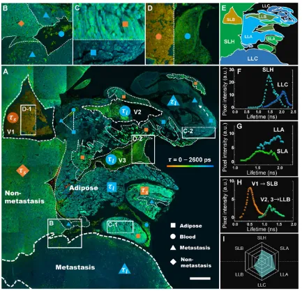 Figure 5. Metabolic features of liver section of metastatic colonization revealed by FLIM