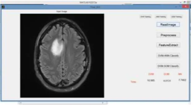 Figure 2(b) MRI data set used for training 