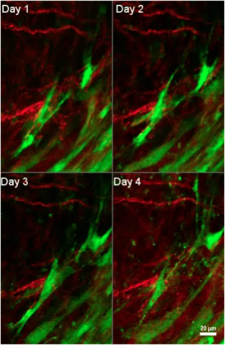 Figure 4. tumor to varying degrees, and occasionally interact with collagen fibers. Figure is generated from data provided by Dr