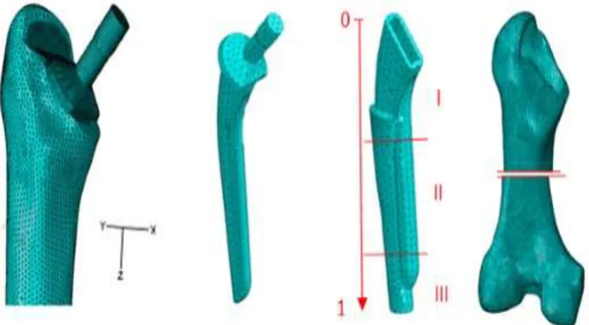 Figure 3: Finite element meshes of hip prosthesis components: a- Cemented hip stem, b-Osteal stem,c-Cement and (d) Femur bone, I: Proximal part, II: Median part and III: Distal part 