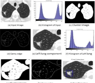 Figure 1. Steps for lung cancer cell detection 