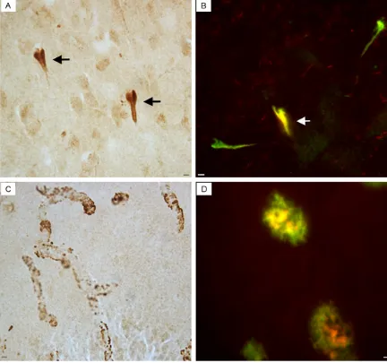 Figure 3. Evidence for apoE immunoreactive pathology in the human VaD brain. (A) Representative labeling utiliz-ing a custom, in house antibody that specifically detects the amino-terminal fragment of apoE shows the presence of immunoreactivity within appa