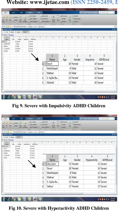 Fig 10. Severe with Hyperactivity ADHD Children 