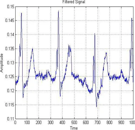 Figure 1 shows the normal ECG signal. The ECG signals captured by utilizing electrodes are always have small 