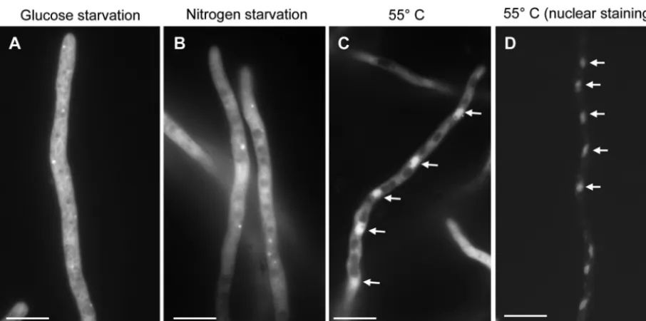 FIG 5 Localization of Hsp90-EGFP under various stress conditions. The Hsp90-EGFP strain was grown for 19 h on coverslips in liquid GMM at 37°C and thenexposed to the stress condition (heat shock [55°C] or glucose or nitrogen starvation) for 1 h, before obs