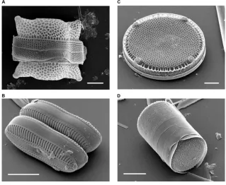 Figure 1.1 Some examples of diatoms found in nature. (Scale bar = 10 micrometers)[1]