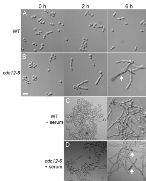 FIG 2 Altered morphology and viability ofWild-type (DIC185) andphase in YPD medium at room temperature