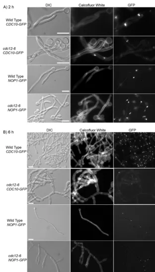 FIG 5 Cell morphology, septin ring, and nuclear localization are altered incdc12-6temperature, serum was added to 20% ﬁnal concentration, and then the cultures were shifted to 37°C for 2 h (A) or 6 h (B)