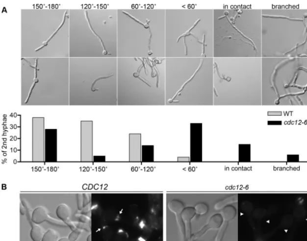 FIG 7 Position of the second germ tube is altered inﬂuorescence microscopy to detect the basal septin band at the junction between the mother cell and germ tube