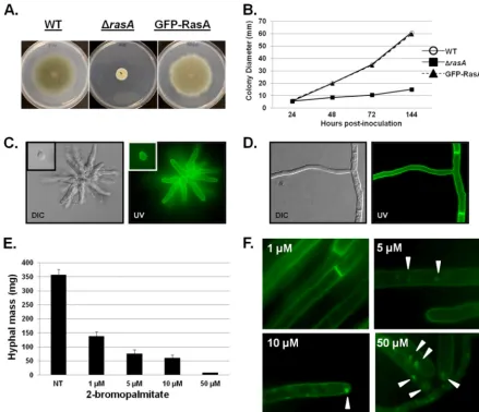 FIG 1 RasA localizes to the plasma membrane and is disrupted by 2-bromopalmitate. (A) Colony morphology comparison of the wild-type (WT), �rasA, andGFP-RasA strains