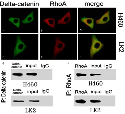 Figure 5. RhoA and delta-catenin expression. RhoA expression was reduced after delta-catenin expression (A, B), and elevated after the forced expression of delta-catenin (C, D)